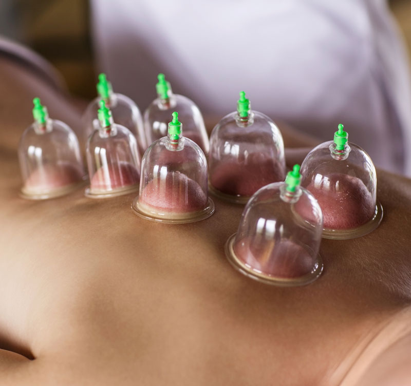 Cupping Treat